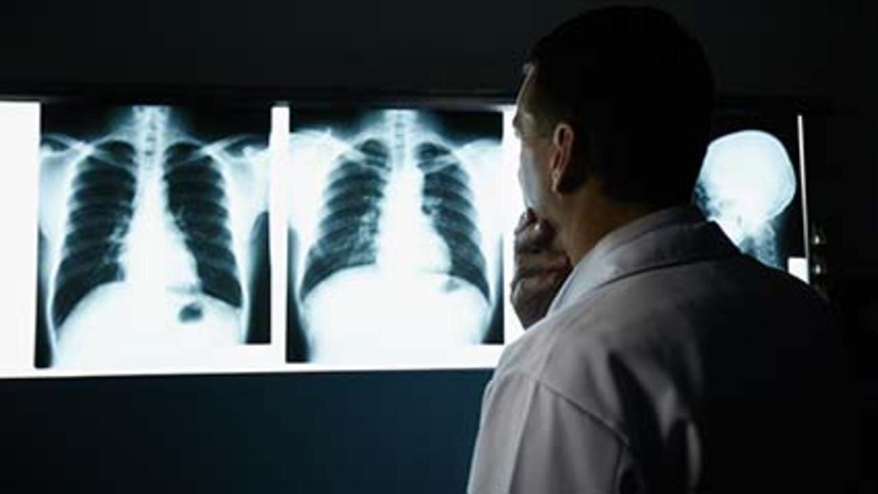 FDA Approves New Drug Offering Hope for Advanced Lung Cancer Patients