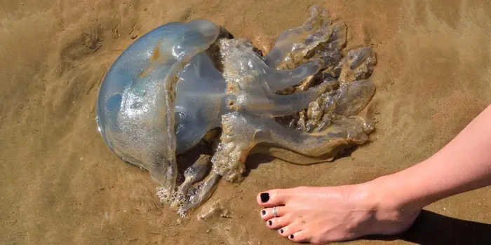 How to Handle Jellyfish Stings: Symptoms, Treatment, and Recovery