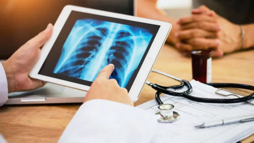 Lung Cancer Screenings Need to Gain More Attention. Here's Why.